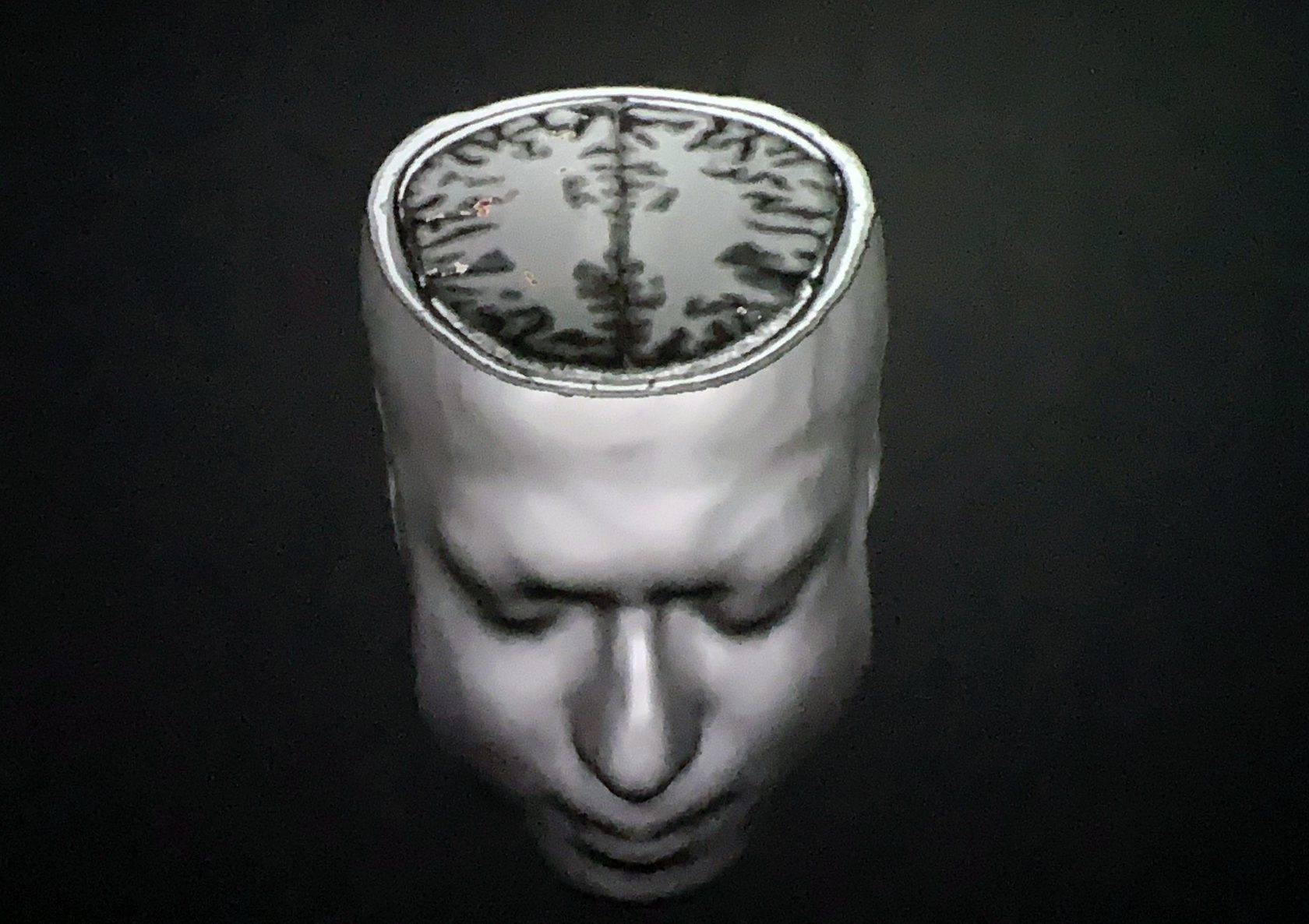 EXTRACT – De nieren, hersenen, longen en meer van Itamar Gilboa